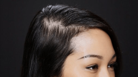 coconut oil regrow hair